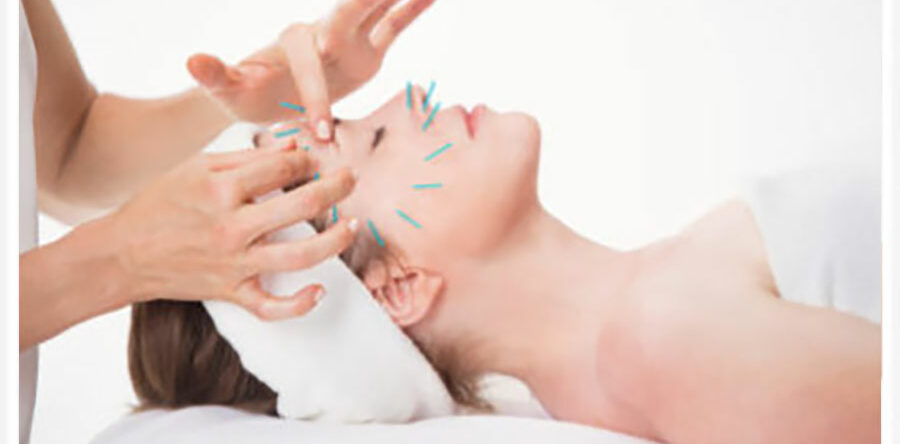 Acupuncture faciale – Montpellier